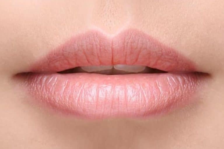 Lip Refresh - Tratamientos Estéticos para Labios